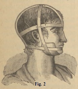 Fig. 2