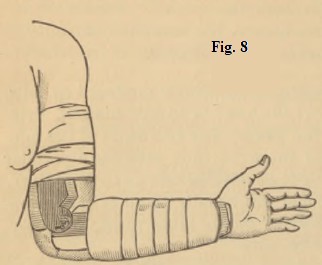 Fig. 8
