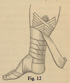 Fig. 12.