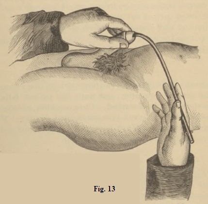 Fig. 13.