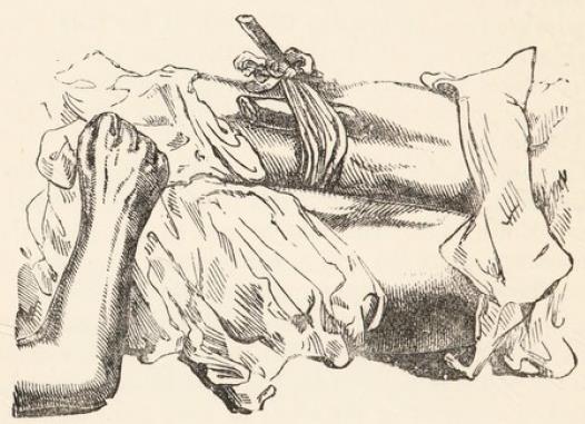 Fig.4