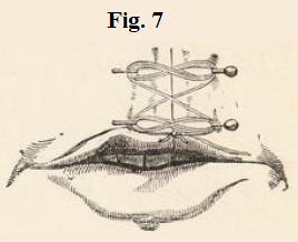 Fig.7.