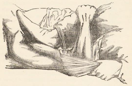 Fig.8.