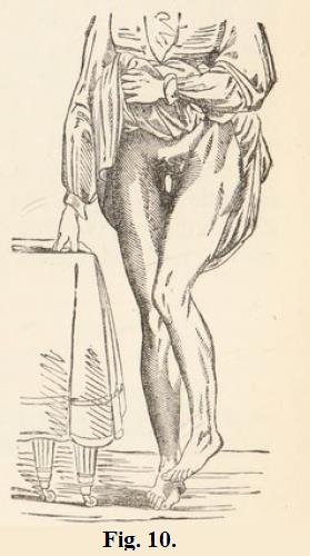 Fig. 10.