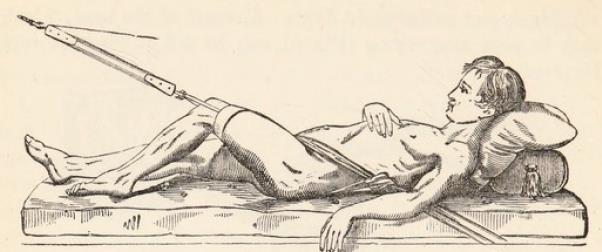 Fig. 11.