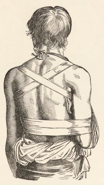 Fig. 15.