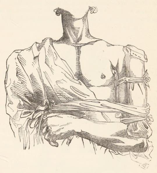 Fig. 16.