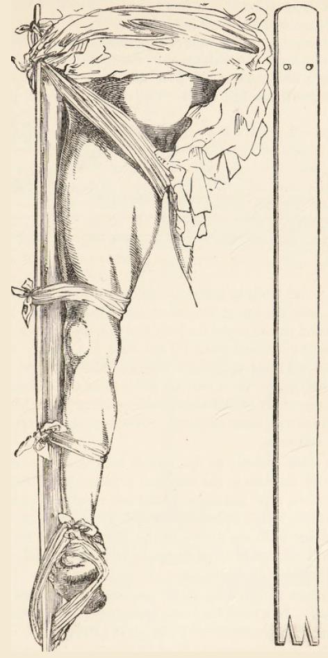 fig20-21. fig20-21.