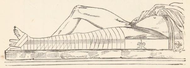 Fig.22.