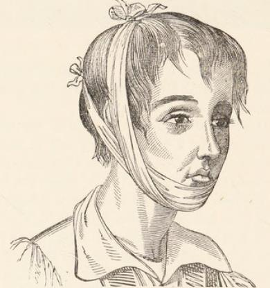 Fig.25.