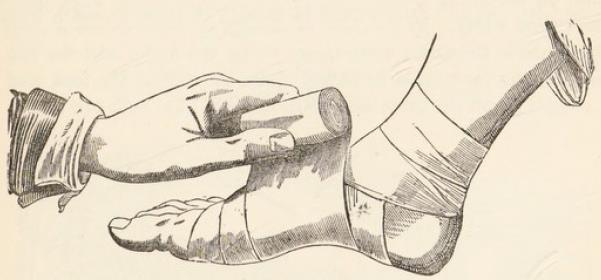 Fig.31.