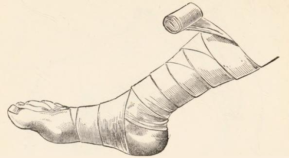 Fig.32.