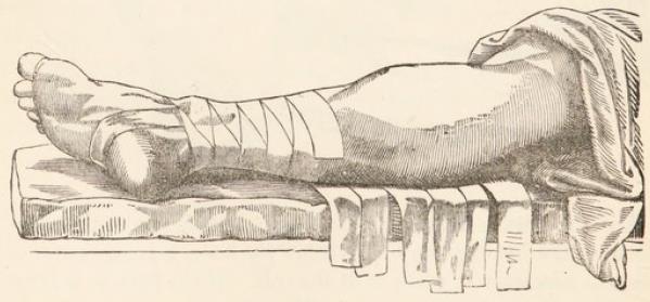 Fig.33.