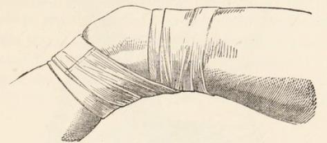 Fig.34.