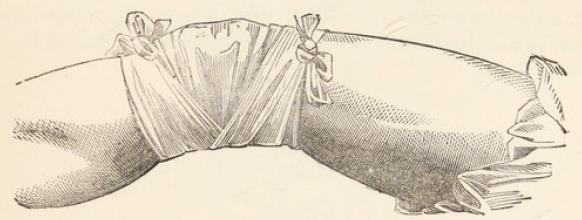 Fig.35.